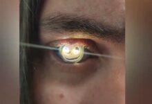 美国一男子将义眼改装成手电筒：发光钛合金眼成真！画风炫酷 - v2ra小站