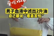274斤男子血管抽出2升“油”！血管怎么变成了“油管”？ - v2ra小站