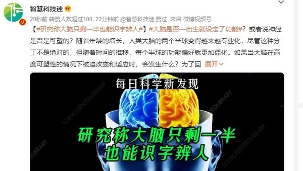 太神奇了!研究称大脑只剩一半也能识别文字和面孔 - v2ra小站