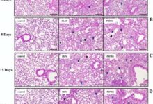 为了更好消毒 韩国人把杀菌剂放入加湿器：上万人惨死 - v2ra小站
