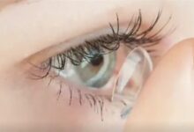 注意！女子角膜长满新生血管：戴隐形眼镜10年、每天长达10小时 - v2ra小站