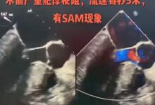 浙江一女子半年笑晕4次上热搜！医生道出病因 - v2ra小站