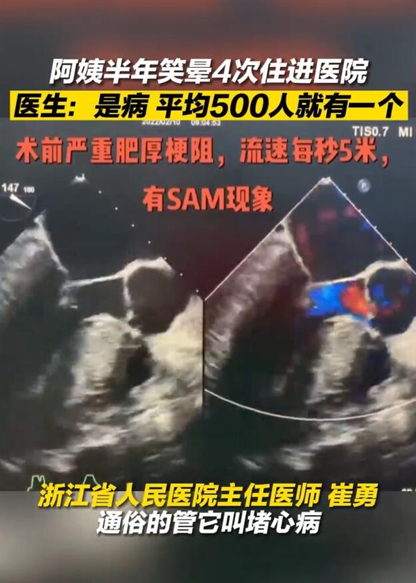 浙江一女子半年笑晕4次上热搜！医生道出病因 - v2ra小站