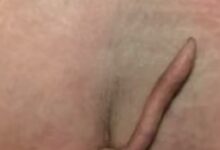 全球仅40例!女婴出生时长5.7厘米尾巴太罕见 医生:属良性组织 - v2ra小站