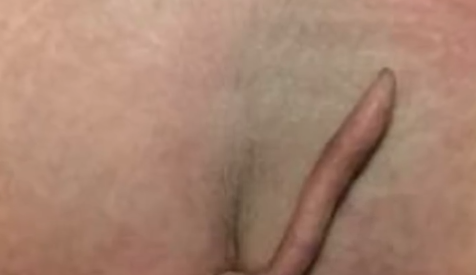 全球仅40例!女婴出生时长5.7厘米尾巴太罕见 医生:属良性组织 - v2ra小站