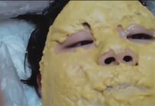 妈妈给女儿脸上“摊大饼”退烧:效果很意外 - v2ra小站