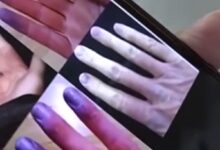 江苏女子遇冷手指就发白变紫 医生科普:免疫系统出问题 - v2ra小站