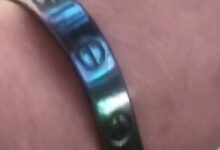 女子退烧后发现银手镯变黑了 真是排毒?网友科普秒懂 - v2ra小站