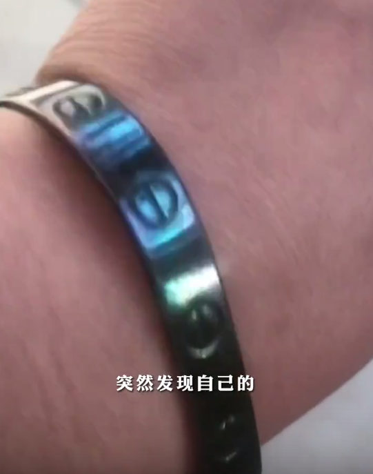 女子退烧后发现银手镯变黑了 真是排毒?网友科普秒懂 - v2ra小站