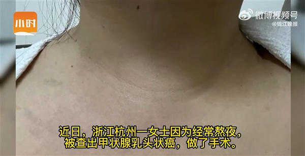女子经常熬夜脖子变粗:一查癌症 - v2ra小站