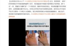 长时间玩手机小心了!大妈常玩手机致手指卡住不能动 - v2ra小站