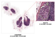腾讯游戏AI能帮医生看片了：超大尺寸扫描病理图像诊断成功验证 - v2ra小站