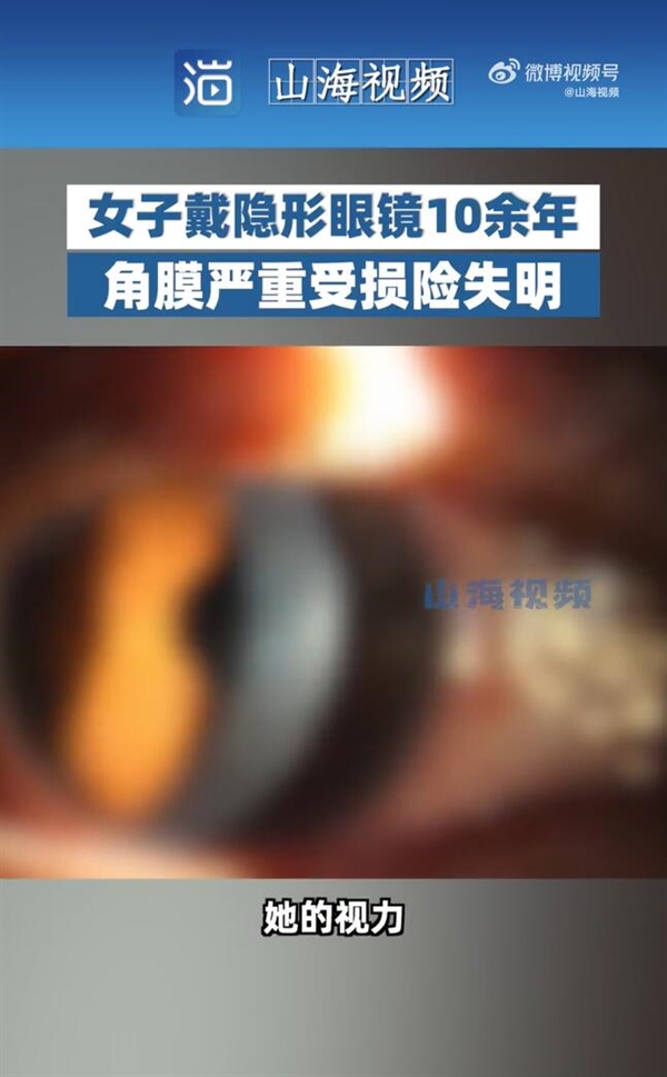 女子连戴10年隐形眼镜角膜受损变色：送医时视力已不足0.1 - v2ra小站